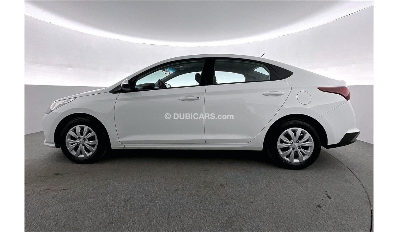 Hyundai Accent Smart / GL | 1 year free warranty | 0 Down Payment